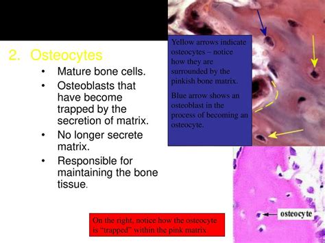 a mature bone cell trapped in bone matrix|More.